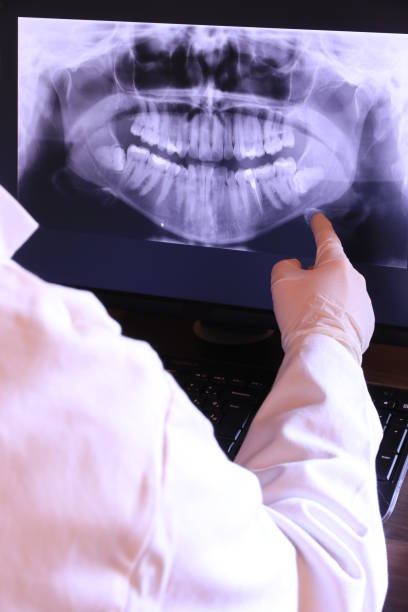 Best Emergency Wisdom Teeth Removal in Bayview, CA