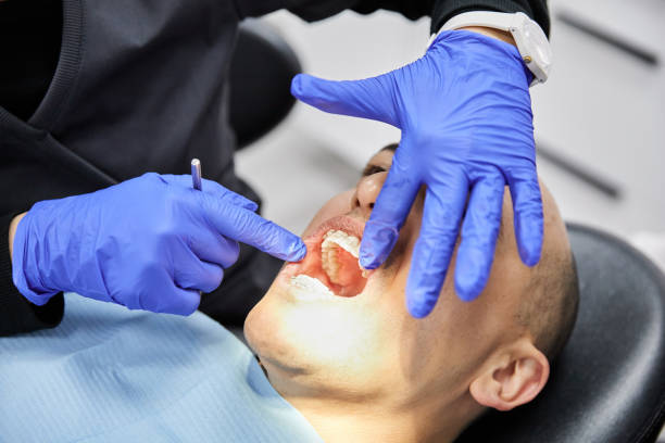 Best Pediatric Emergency Dentist in Bayview, CA